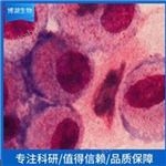 OP9小鼠骨髓基質(zhì)細(xì)胞供應(yīng)商