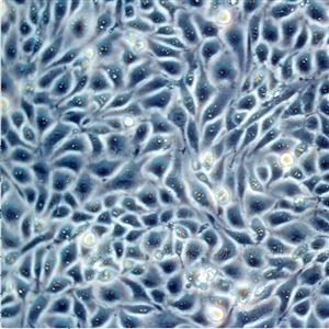 BT428MS1小鼠胰岛内皮细胞T25